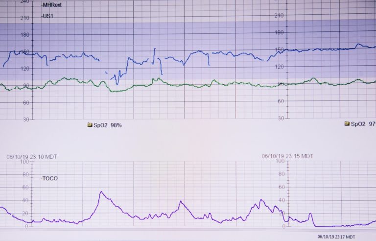 What Does A BAER Test Consist Of Nassau Suffolk Neurology